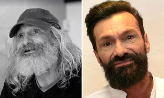 Comparison of Homeless José before and after "Transformation"